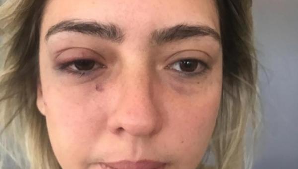 Advogada foi agredida na quinta-feira (06) em seu apartamento em João Pessoa. (Foto: Reprodução).