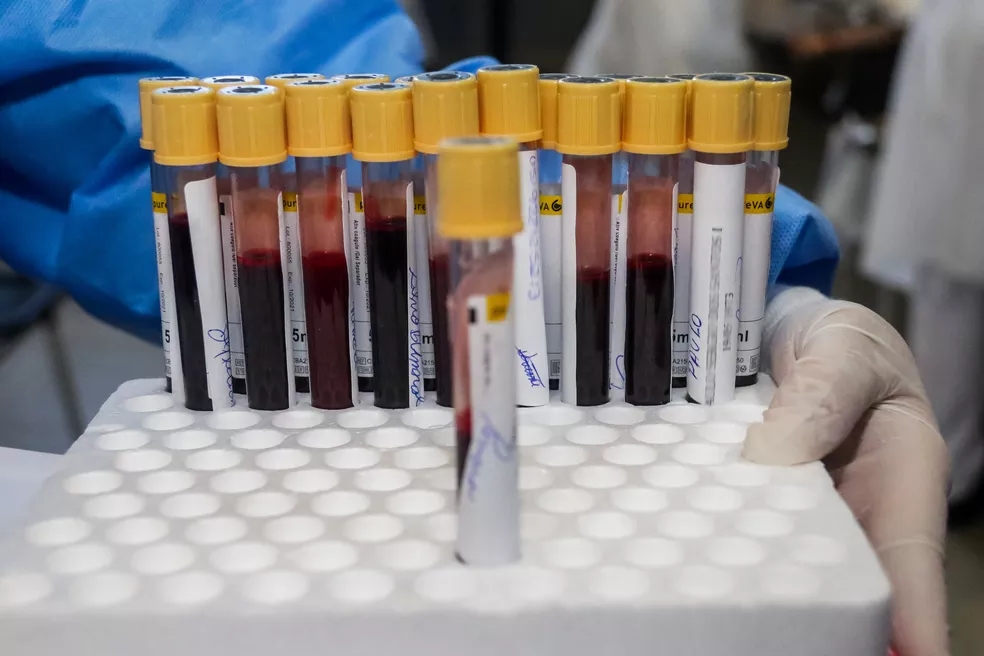 Tubos de exame de sangue para teste da Covid-19 no estado de São Paulo (Foto: Cadu Rolim/Estadão Conteúdo)