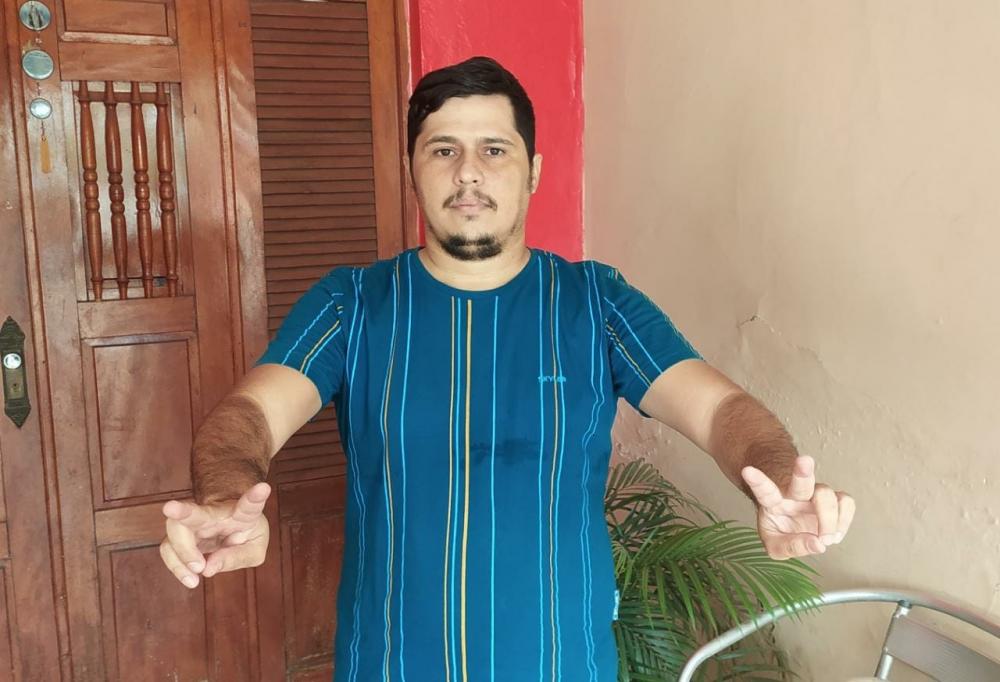 Alisson foi candidato único na eleição para composição da diretoria do Sindicato. (Foto: Debate Paraíba).