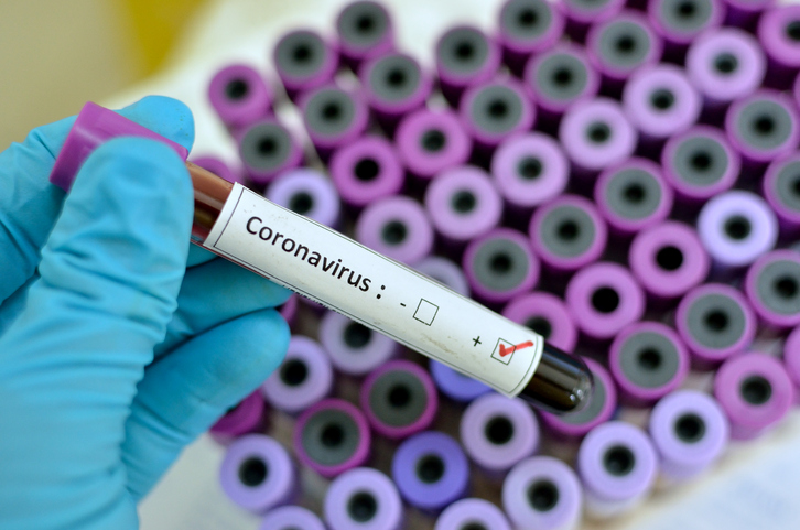 Segundo caso de Coronavírus é confirmado (Foto: Reprodução).