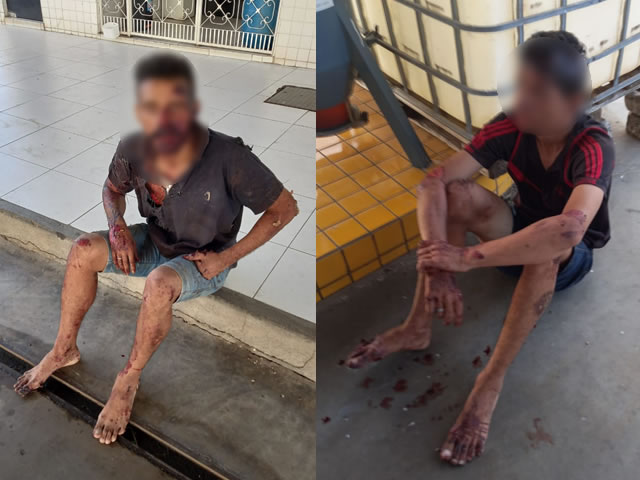 Os homens foram socorridos ao Hospital Regional de Sousa e após receberem alta médica foram levados à delegacia de Polícia Civil para serem adotados os procedimentos que determina a Lei (Foto: Reprodução)