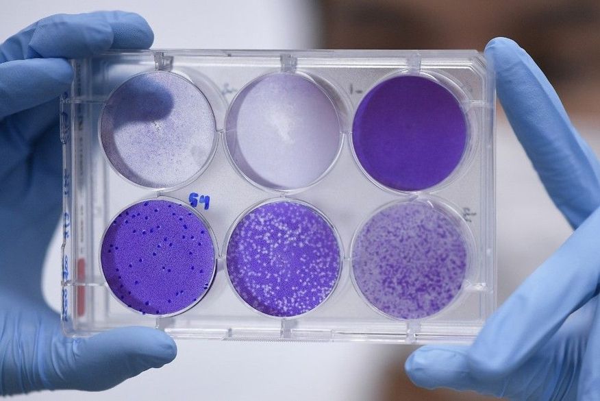 Para chegar a uma vacina efetiva, os pesquisadores precisam percorrer diversas etapas, passando por testes pré-clínicos, que podem ser in vitro ou em animais (Foto: Reprodução).