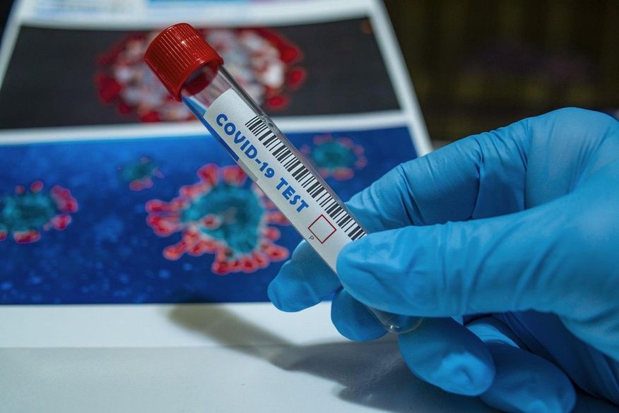 Até o momento, já foram realizados 1.362.182 testes para diagnóstico da Covid-19. (Foto: Reprodução)