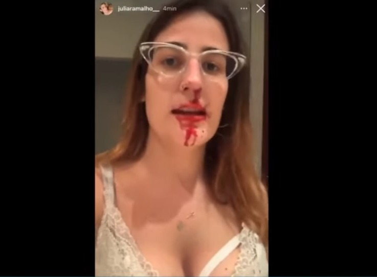 Após o caso ser registrado, a Polícia Civil irá dar início as investigações e a suposta agressora deverá prestar depoimento nos próximos dias (Foto: Reprodução)