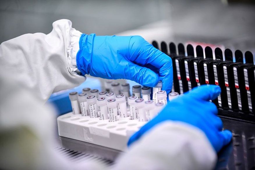 O levantamento utiliza amostras de pacientes que apresentaram os três diferentes graus de manifestação do novo coronavírus: leve, moderado e grave. (Foto: Reprodução).