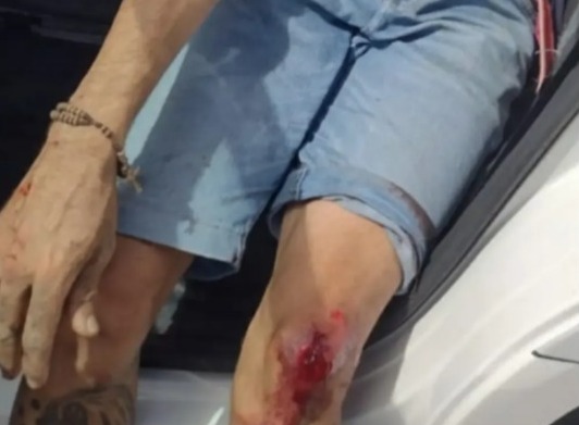 O caso será investigado pela Polícia Civil, com o intuito de identificar e prender os suspeitos de cometerem o crime (Foto: Reprodução)