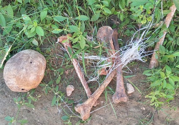 Nos próximos dias o laudo pericial deverá ser revelado, com a possível identificação da vítima (Foto: Reprodução)