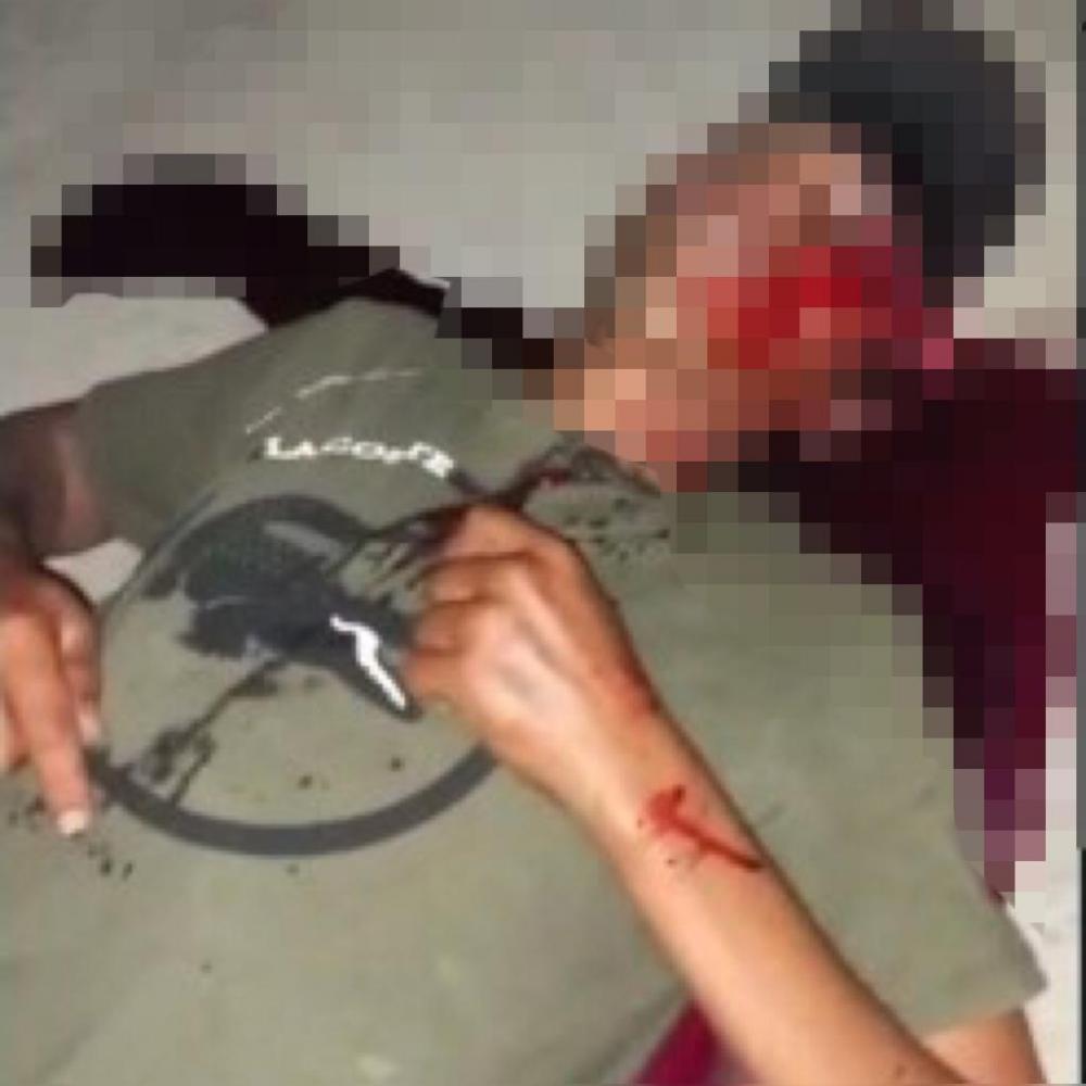O caso será investigado pela Polícia Civil, com o objetivo de identificar e prender o suspeito (Foto: Reprodução)