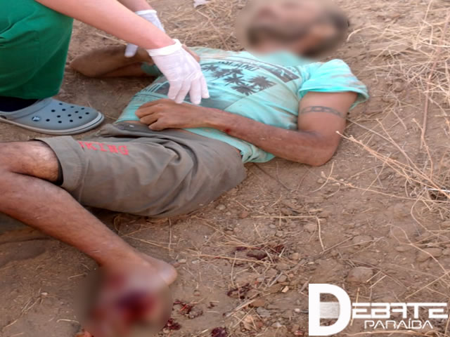 Segundo informações, a vítima que veio a óbito teria sofrido um grave traumatismo craniano encefálico. (Foto: Reprodução Redes Sociais).