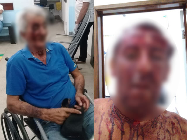 Diante da resistência das vítimas, os criminosos foragiram do local tomando destino ignorado sem subtrair nada de valor. (Foto: Reprodução Redes Sociais).