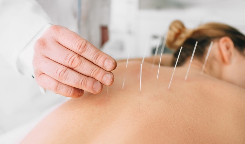 O SUS já adota acupuntura e homeopatia mas a oferta das terapias depende do gestor municipal - PeakSTOCK