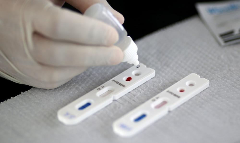 Conforme o edital, o objetivo e atender as necessidades do município, frente a demanda de casos suspeitos e maior identificação de possíveis casos. (Foto: Reprodução).