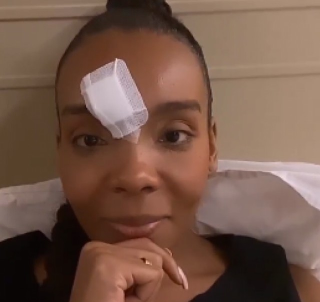 No Instagram, Thelma explicou que pisou em falso e caiu do palco, com o rosto no chão.