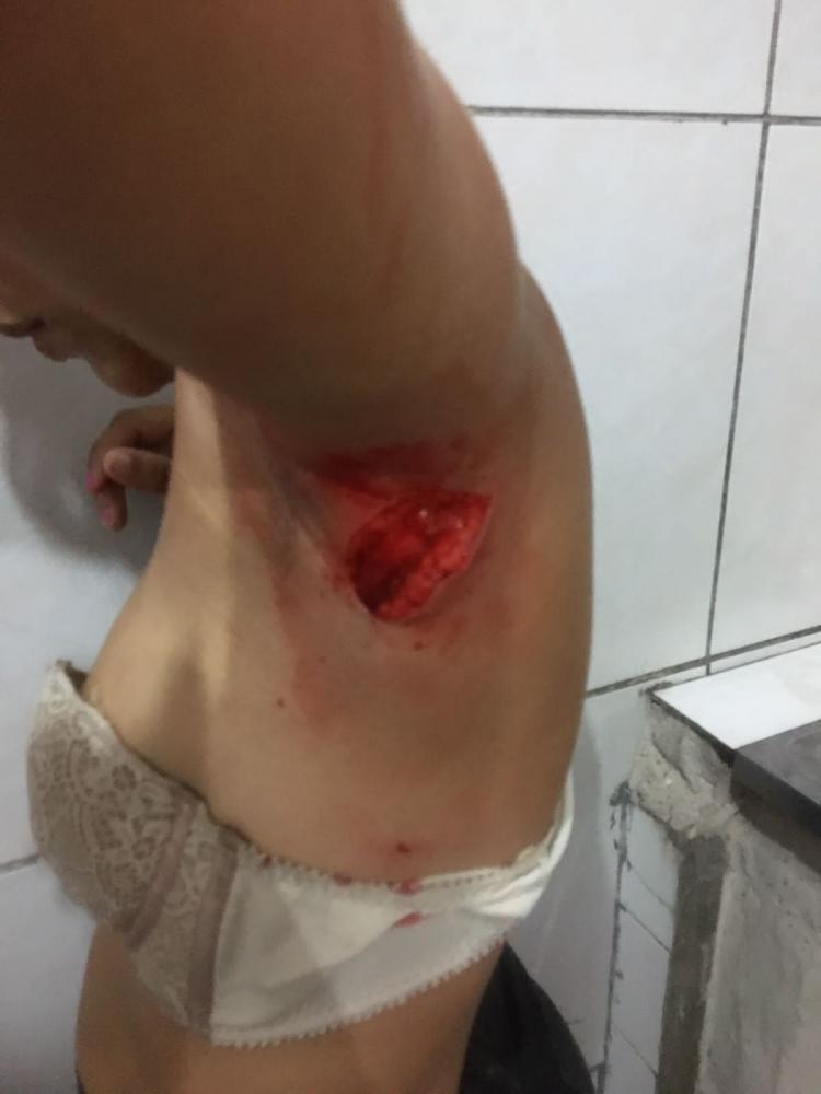 A menor infratora antes de cometer o ato infracional semelhante a lesão corporal grave, teria abraçado e beijado a vítima. (Foto: Reprodução).