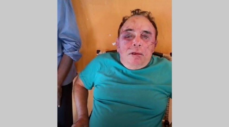 (Foto: Reprodução Redes Sociais)