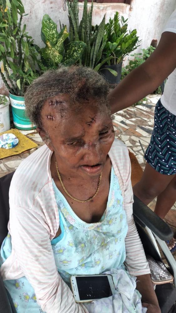 Familiares relataram que o investigado estava embriagado e praticou o atentado contra a própria mãe no momento em que todos dormiam na residência, tendo ele foragido antes da chegada da Polícia Militar. (Foto: Reprodução).