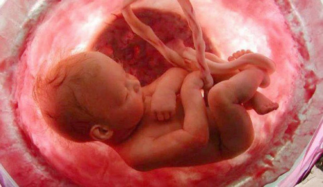 Mãe confessa que praticou aborto e pagou quantia de R$ 4 reais para mototaxista jogar feto embaixo da ponte no município de Patos