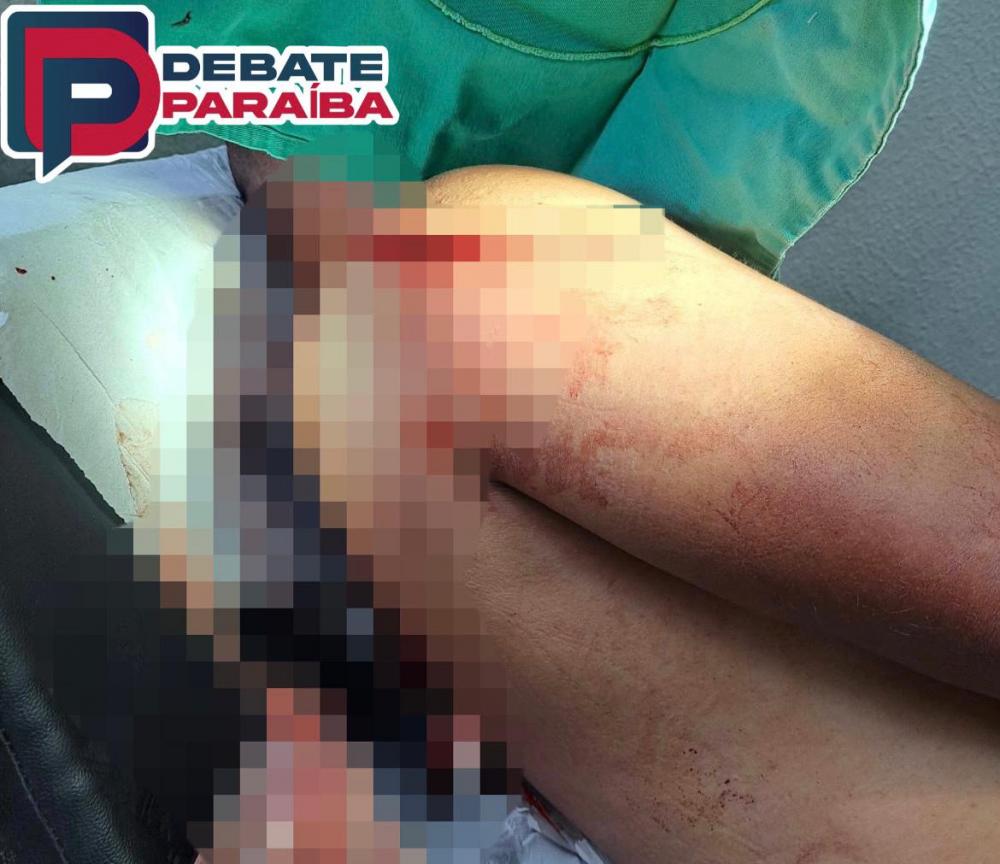 Diligências estão sendo realizadas pela Polícia Militar em toda a região, porém sem êxito na captura da mulher até o presente momento (Foto: Reprodução)