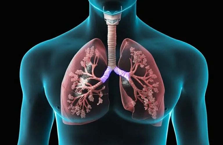 A situação de emergência está decretada pelo período de 90 dias, prorrogáveis, em razão do aumento de casos da Síndrome Respiratória de etiologia viral. (Foto: Reprodução).